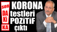 FLAŞ…FLAŞ…FLAŞ… TARSUS BELEDİYE BAŞKANI BOZDOĞAN KORONA’YA YAKALANDI!