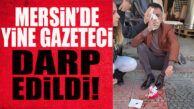 MERSİN’DE YİNE BİR GAZETECİYE SALDIRI: BIÇAKLA SALDIRDILAR, BURNUNU KIRDILAR!